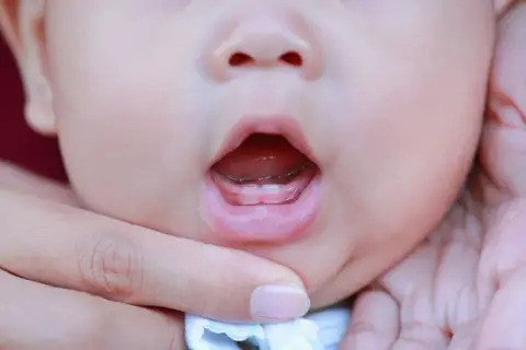 Le prime gemme dei denti dei bambini spuntano, un piccolo sorriso che promette tante scoperte.